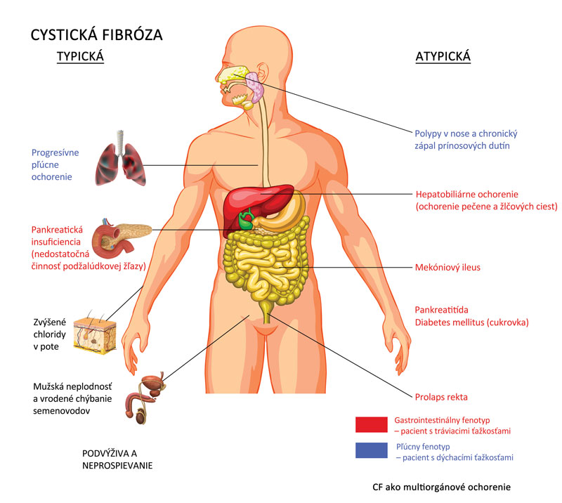 Co to je fibróza?